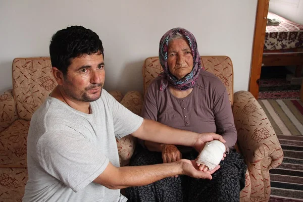 Erdemli'de sahipsiz köpeğin saldırdığı yaşlı kadın elinden yaralandı